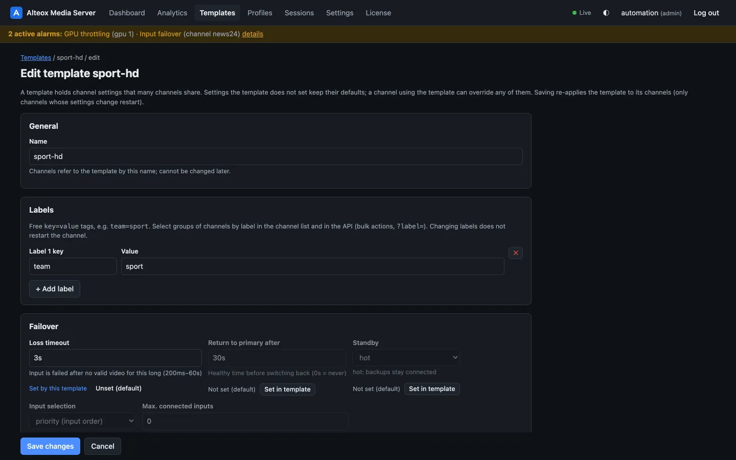Channel template editor